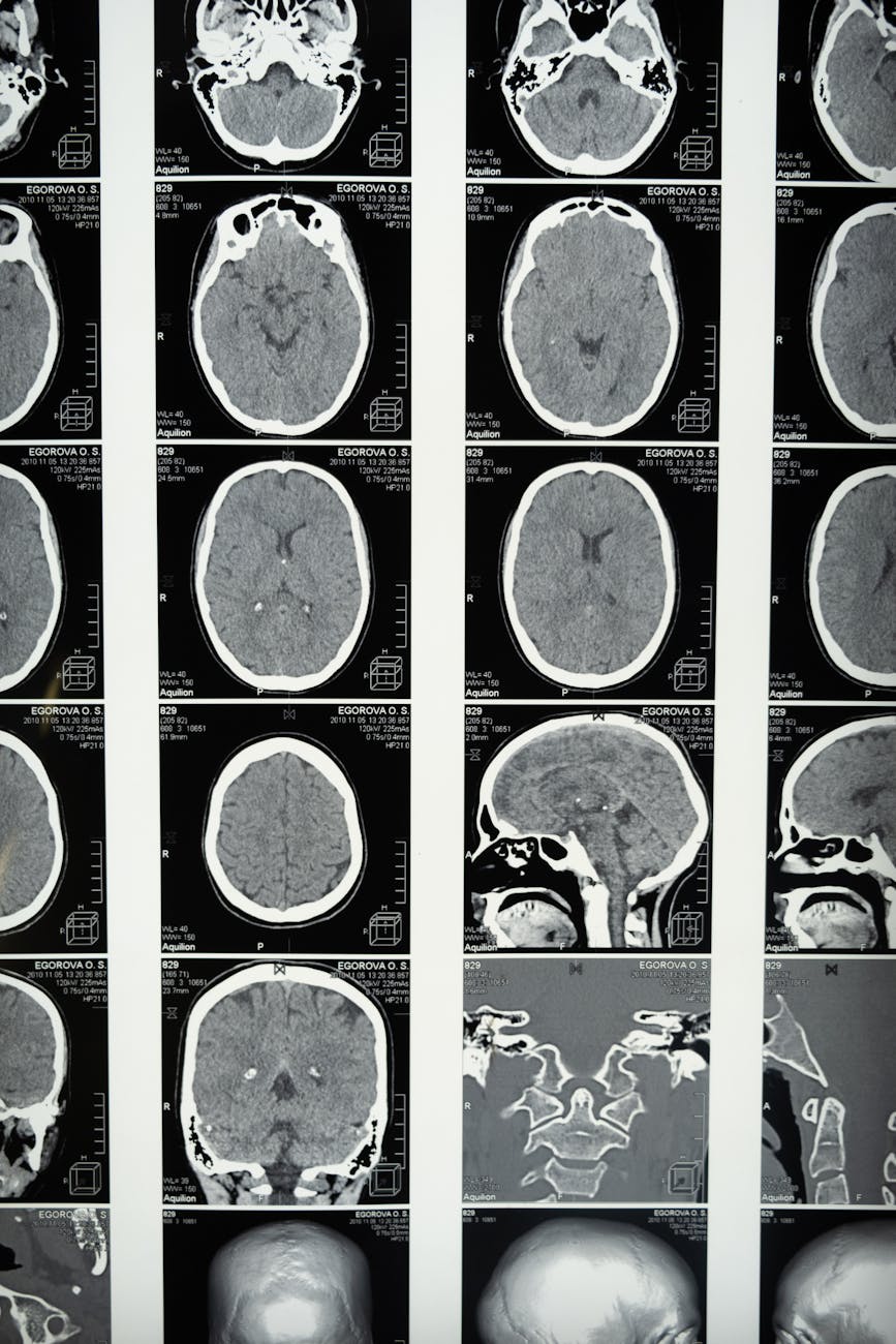 An example of an AI-analyzed medical image