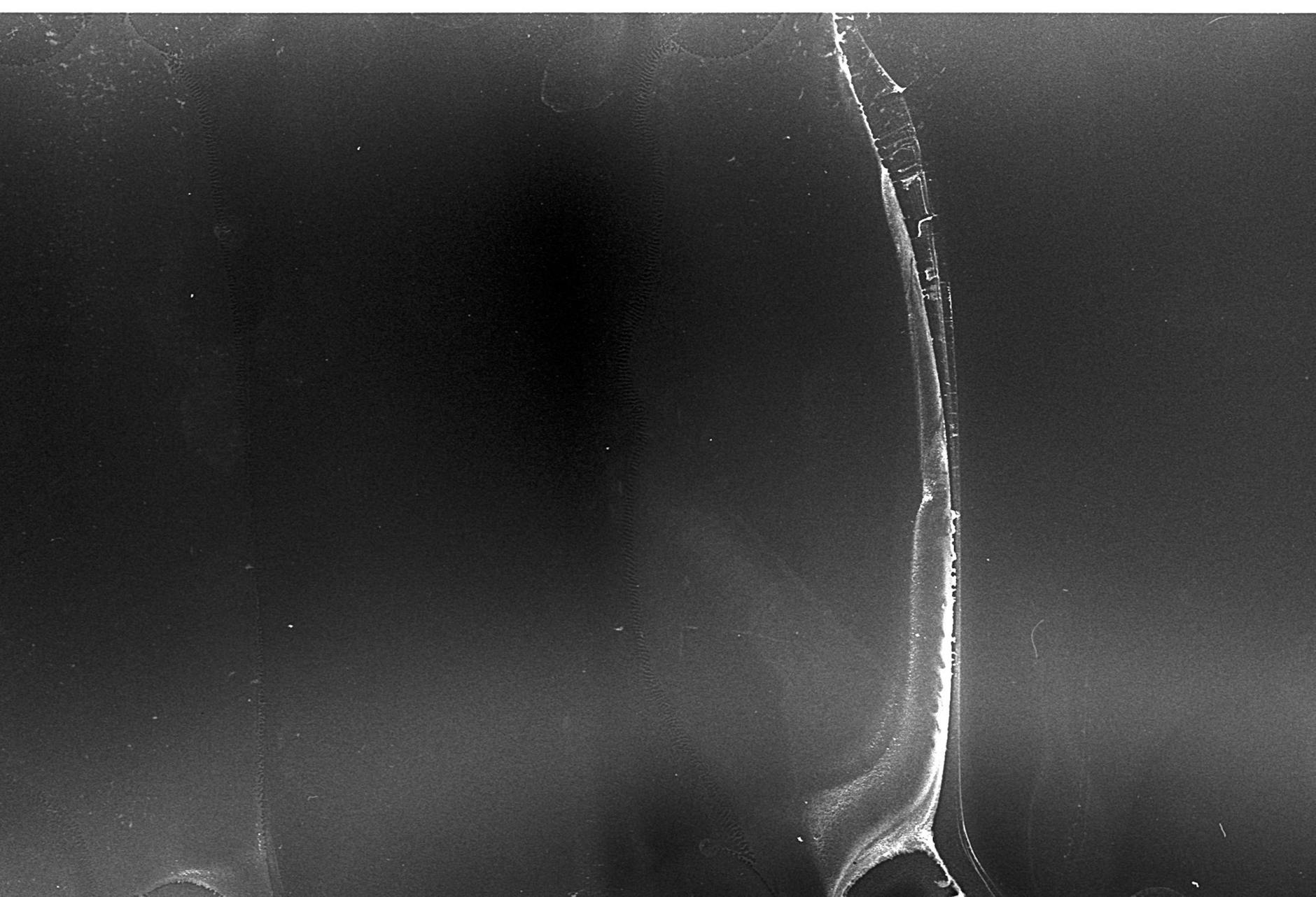 A split image showing a traditional X-ray on one side and an AI-enhanced X-ray highlighting subtle anomalies on the other, with a glowing digital overlay.