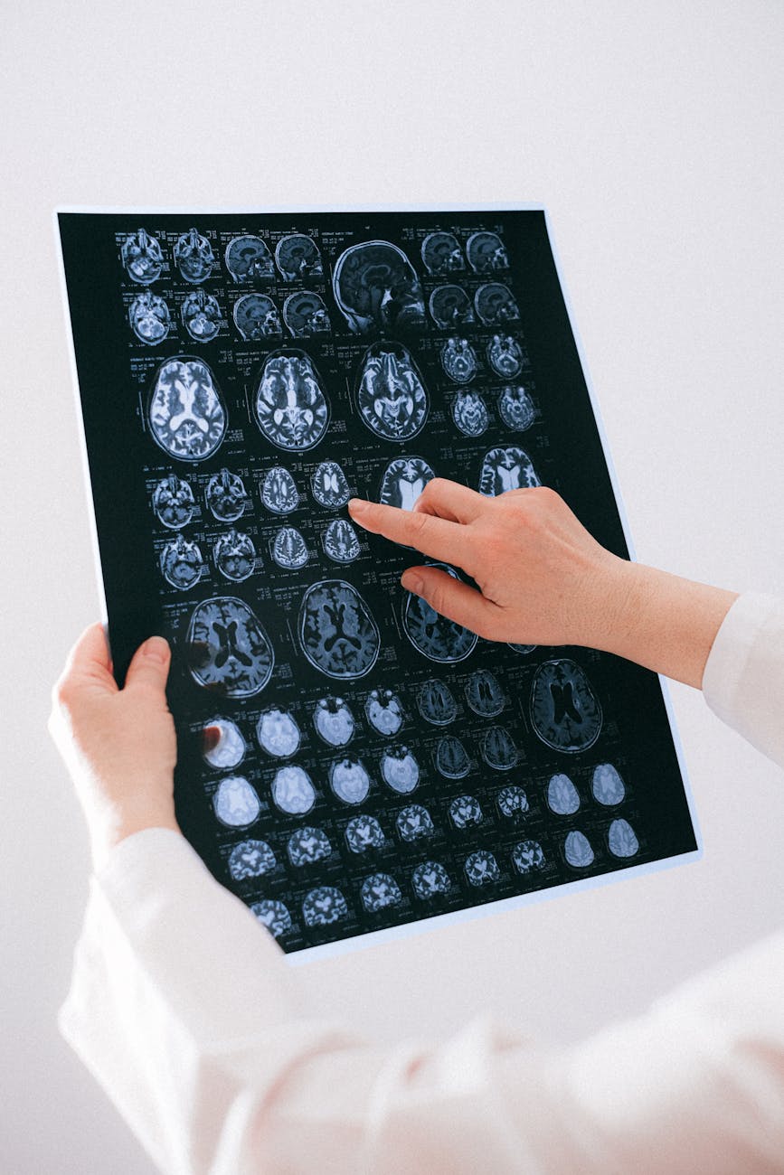 OoC Model of the Brain