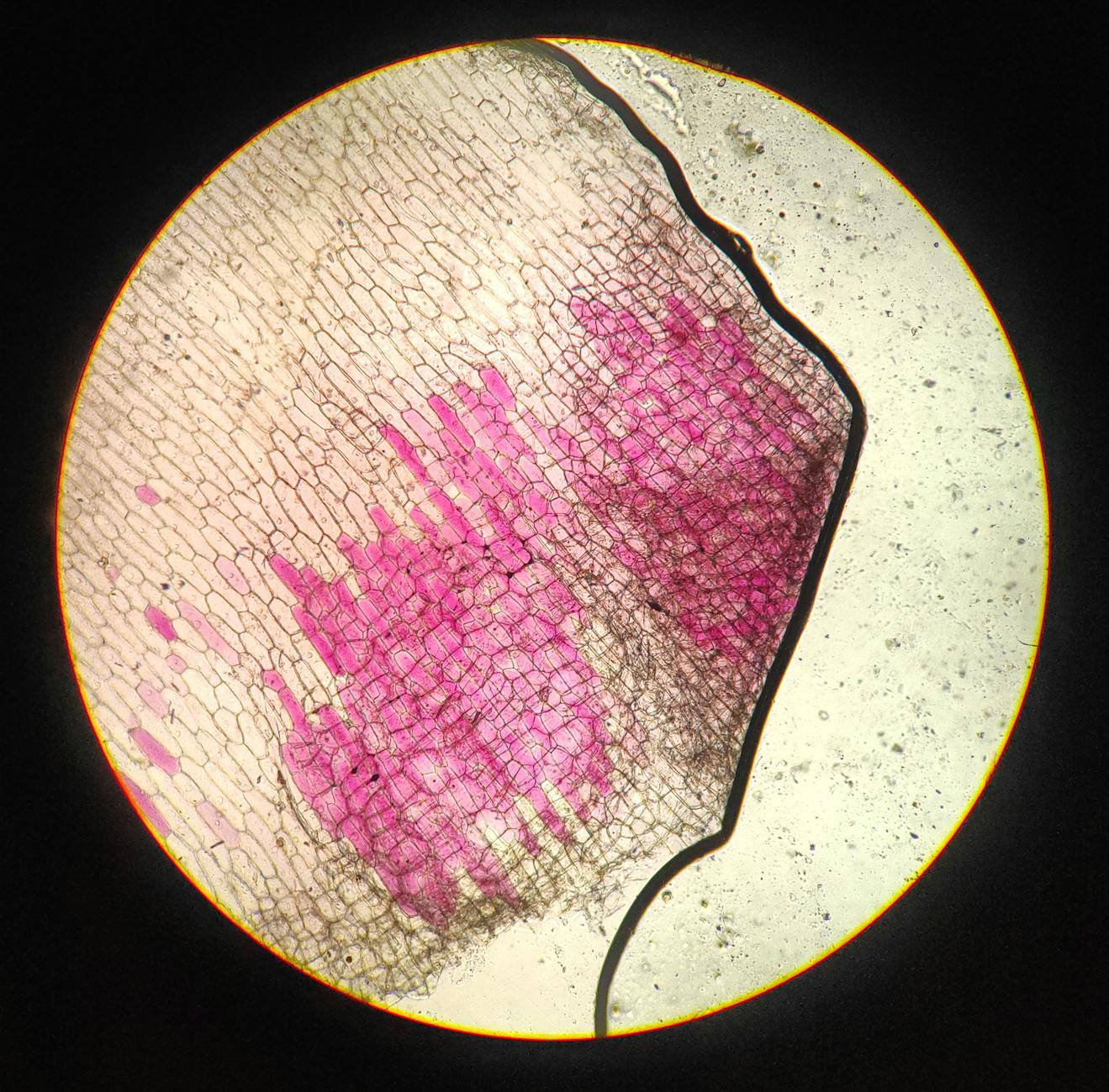Microscopic view of senescent cells with visible SASP factors being secreted.