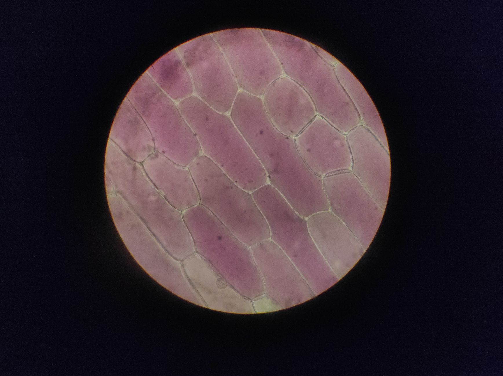 Microscopic view of senescent cells, characterized by their enlarged morphology and distinct cellular markers, contrasted with healthy, dividing cells.