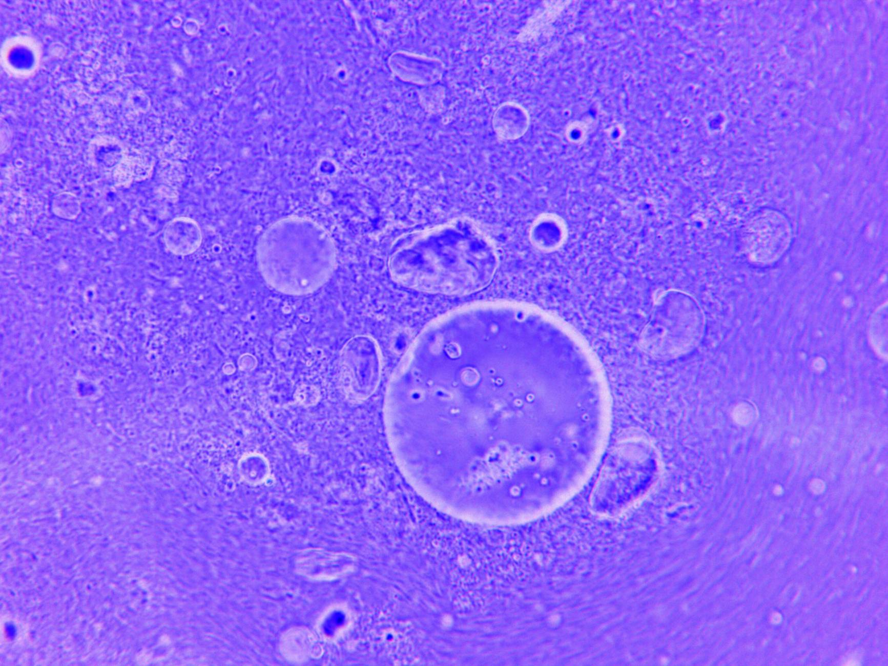 Microscopic view of senescent cells, characterized by their enlarged morphology and distinct cellular markers, contrasted with healthy, dividing cells.